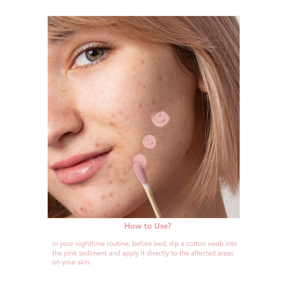 Active Acne Drying Lotion (30ml)