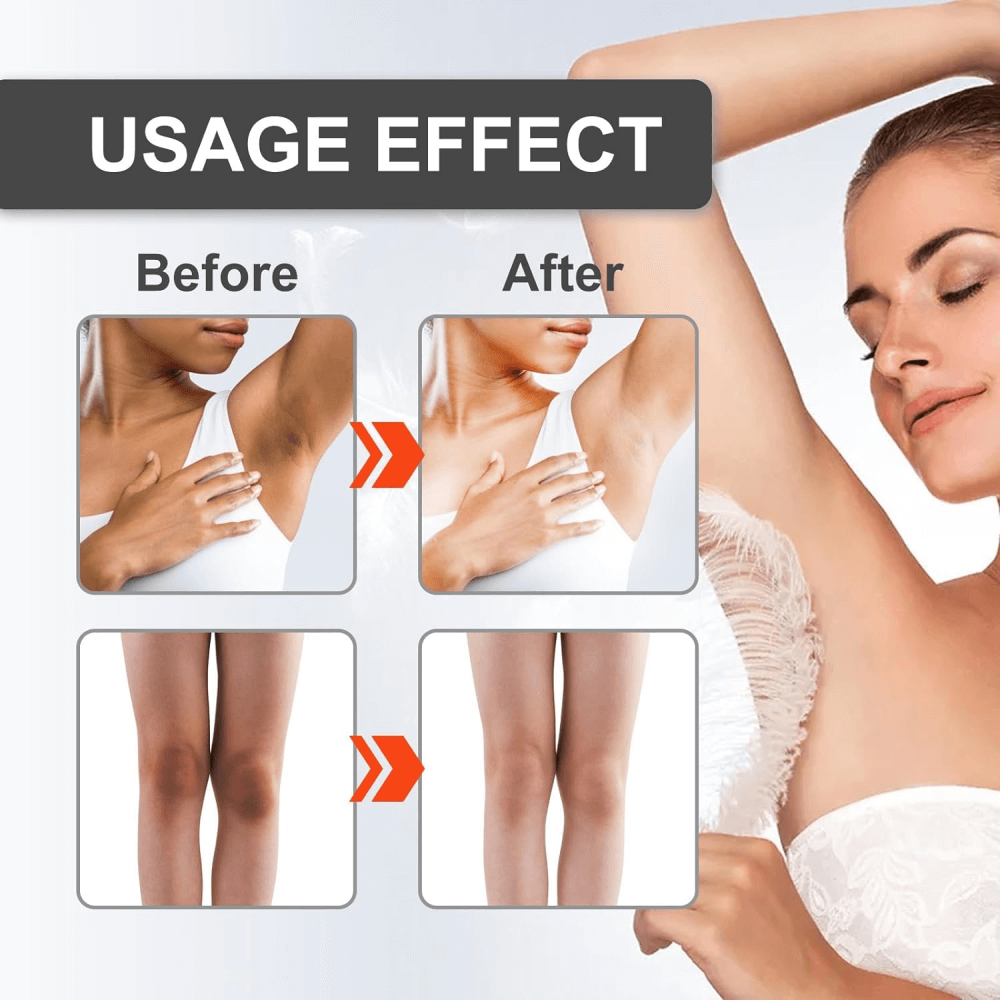 Embeauty Skin Whitening Brightening Anti-Blemish Care Cream 30 SPF 100 ml
