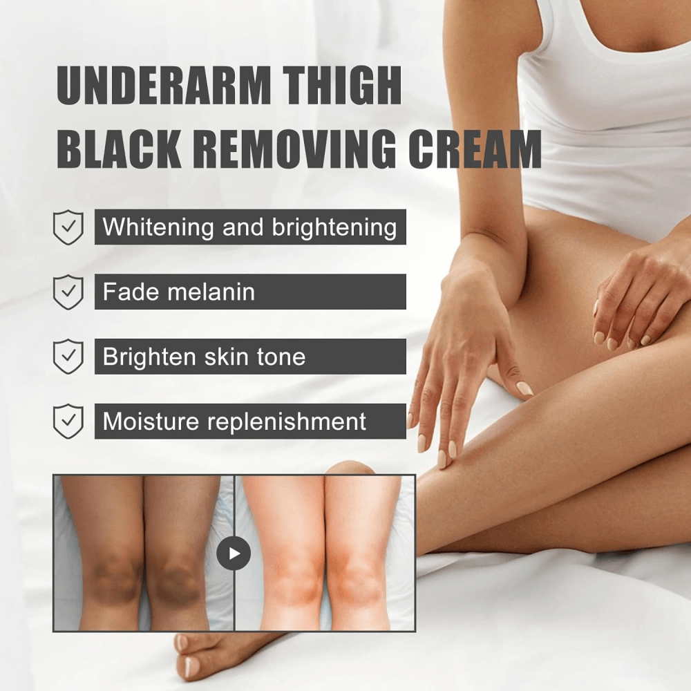 Embeauty Skin Whitening Brightening Anti-Blemish Care Cream 30 SPF 100 ml