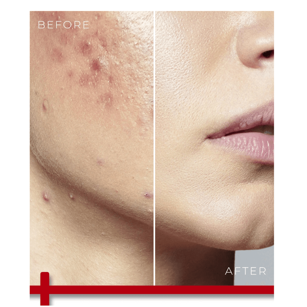Repair Cream - Retinol Shea Butter Hyaluronic Acid 5% Collagen 2% Arbutin 2%
