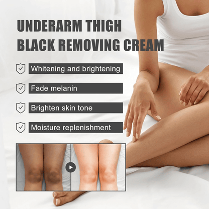 Embeauty Skin Whitening Brightening Anti-Blemish Care Cream 30 SPF 100 ml